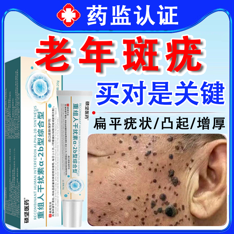 脸上肉粒疙瘩去除膏