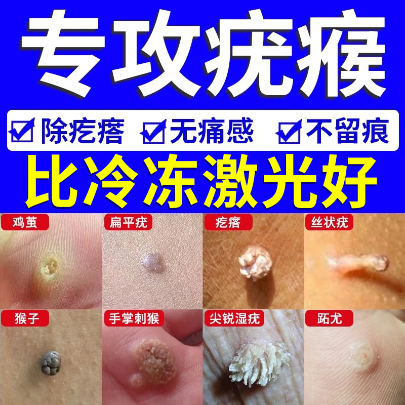 扁平疣去除软膏一抹灵去疣尤瘊专根斩除根祛疣小肉粒医用疣清宁AY