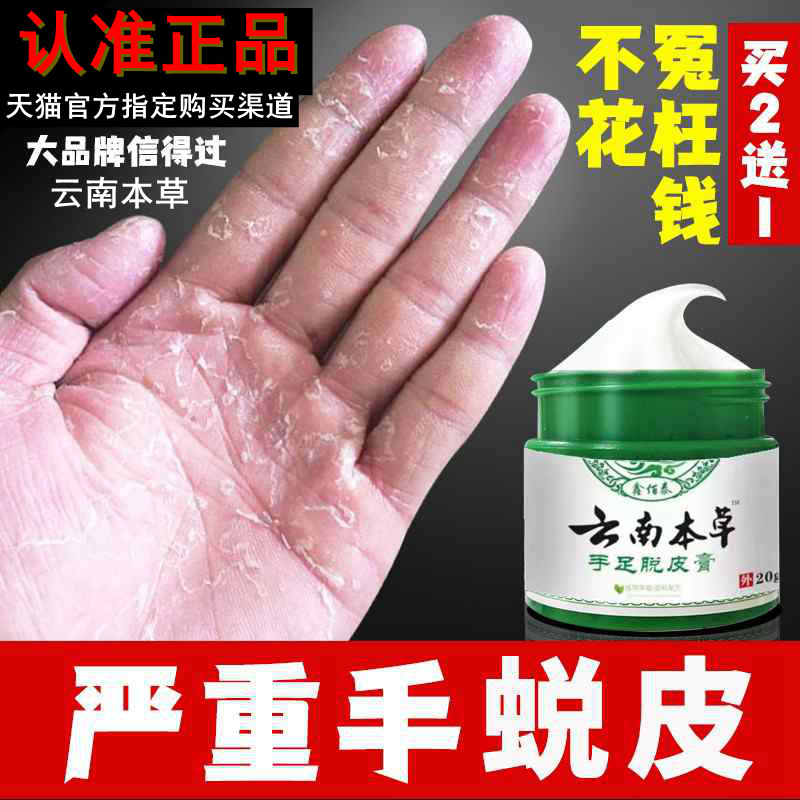 手足脱皮膏正品手指上起皮干燥儿童手掌蜕皮脚底手脚掉皮严重专用