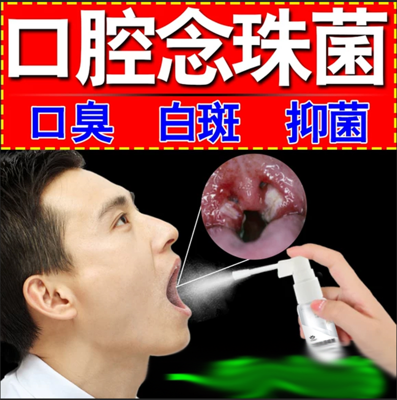 理疗白色念珠菌口腔白斑专用一喷立消滤泡增生黏膜肿疼痛抑菌液