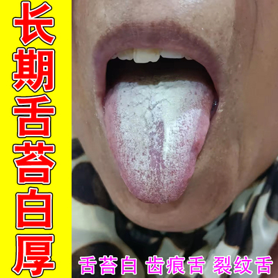 舌苔厚白有裂纹舌面发涩发干居家温和护理液口腔舌部养护清爽不刺