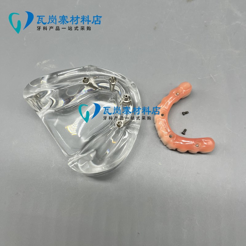 牙科口腔模型马龙l连桥义齿修复种植牙齿仿真演示模拟教学医患沟
