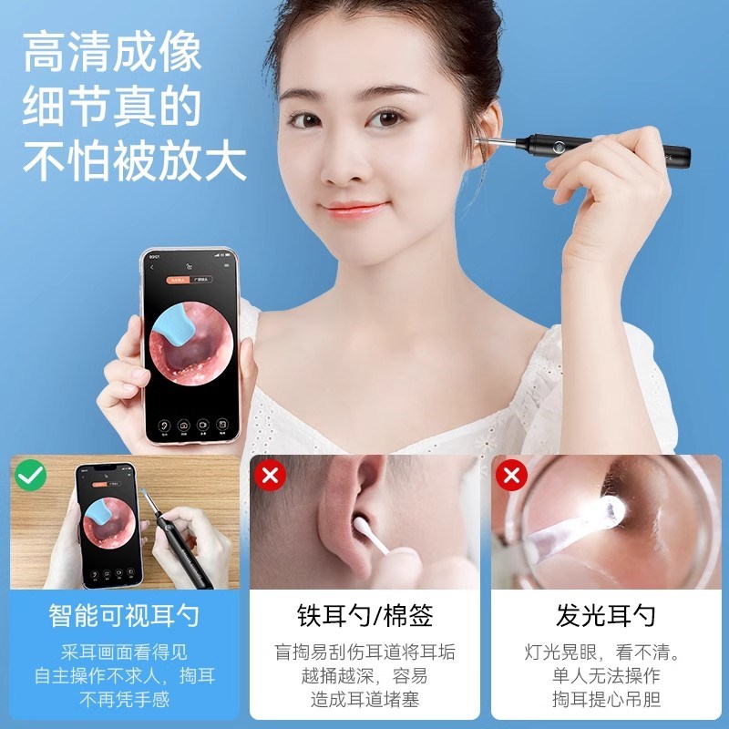 FONSI高清可视掏耳勺发光耳勺儿童婴儿掏耳神器采耳掏耳勺套装