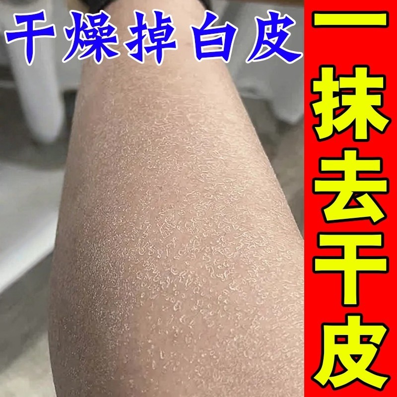 秋天身上皮肤干燥起皮掉皮屑瘙痒补水保湿腿上鱼鳞皮皮肤干燥修复,美容护肤/美体/精油,身体乳/霜,淘宝优惠券,粉丝福利购,淘宝优惠卷