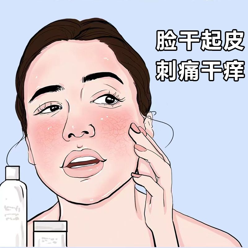 脸上起皮掉皮干皮脸干燥起皮痒脸上起皮干燥脸干痒身体乳止痒润肤