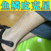 去除鱼鳞病皮肤神器修复霜改善腿部干燥起皮掉皮屑保湿 补水身体乳