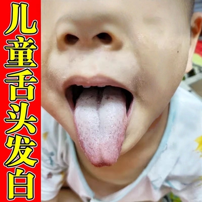 儿童舌头裂纹有齿痕舌苔发白厚舌头中间裂痕疼痛湿气重胃口差积食