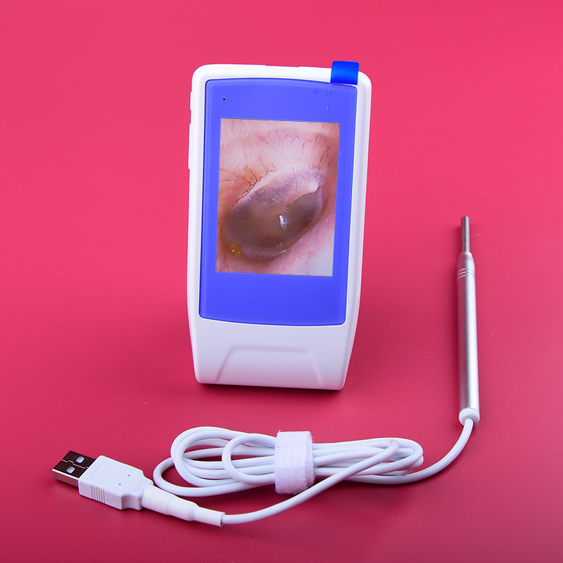 高清可视挖耳勺检测耳鼻喉内窥镜耳朵清洁扣耳勺采耳工具掏耳朵