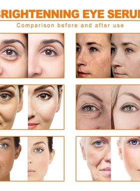 10ml Turmeric Essential Oil 10ml Organic Tumeric Oil For Dar