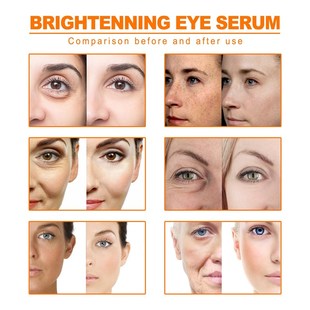 Oil Essential Organic Tumeric Dar 10ml For Turmeric