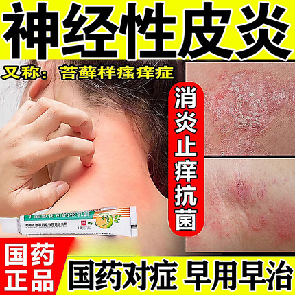 治疗神经性皮炎皮肤病癣藓湿疹真菌感染皮肤瘙痒止痒抑菌外用药膏