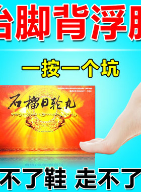 治浮肿脚背浮肿四肢浮肿老人脚肿腿肿水肿消肿效药石榴特日轮丸