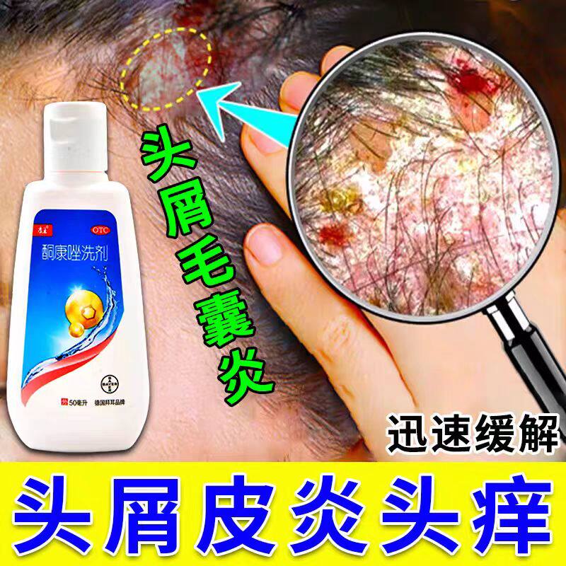【七里香】酮康唑洗剂2%*50ml/瓶