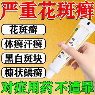 汗斑花斑癣特专用效药膏快白斑速手股藓汗斑白斑花斑糠疹真菌感染