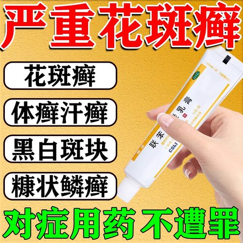 汗斑花斑癣专用药膏快消白斑速手股藓汗斑白