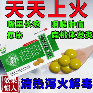 上火清热解毒去火的药牙龈咽喉肿痛喉咙扁桃体发炎消炎特专效用药