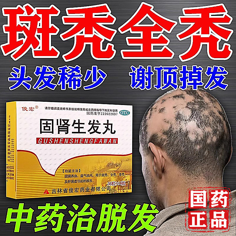 固肾生发丸斑秃治疗药脱发生发掉头发调理肾虚型脱发头发稀疏中药