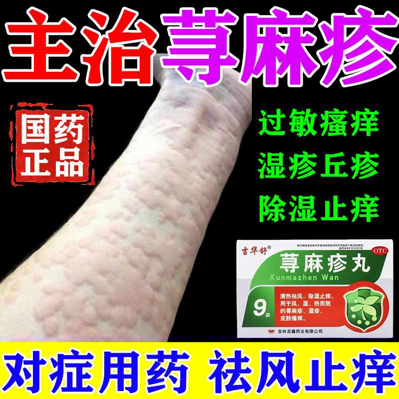 荨麻疹中成药 治疗过敏瘙痒红疹风团长疙瘩除湿止痒 荨麻疹丸正品