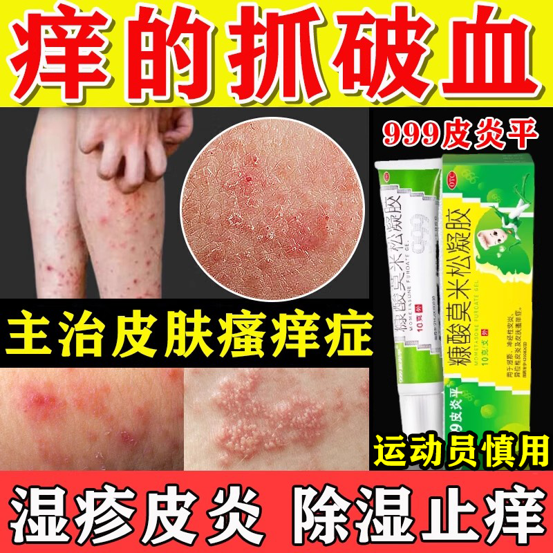 湿疹止痒去外用皮炎平999糠酸莫米松凝胶软膏根正品官方旗舰店,OTC药品/国际医药,抗菌消炎,淘宝优惠券,粉丝福利购,淘宝优惠卷