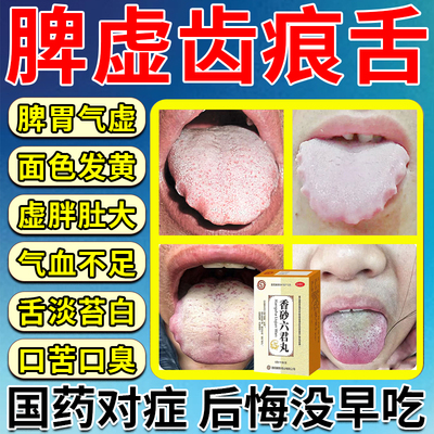 【冯了性】香砂六君丸9g*10袋/盒