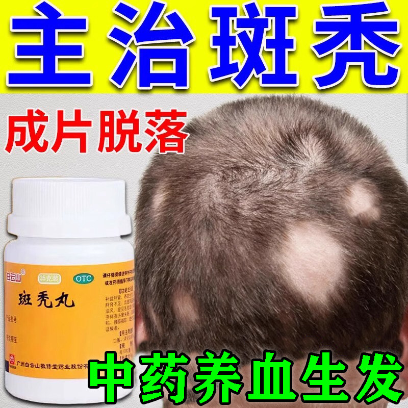 斑秃丸治疗掉头发的药特鬼剃头效药生发育发增发中药成片掉吃什么