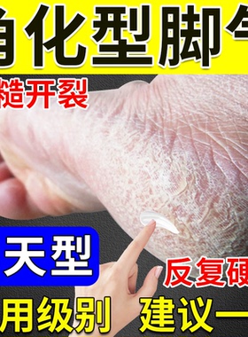 角化型脚气药】止痒脱皮烂脚丫真菌感染手足癣脚后跟增厚硬化干裂