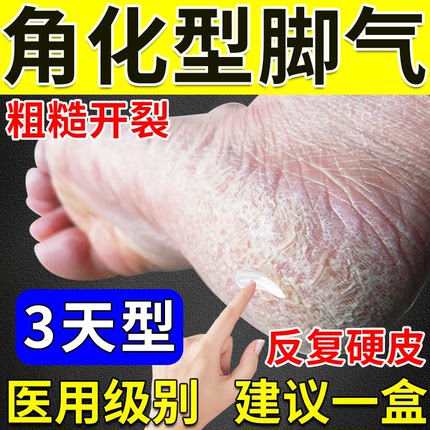 角化型脚气药】止痒脱皮烂脚丫真菌感染手足癣脚后跟增厚硬化干裂
