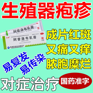 治生殖器疱疹感染药膏红肿瘙痒病毒感染防复发传染药阿昔洛韦乳膏