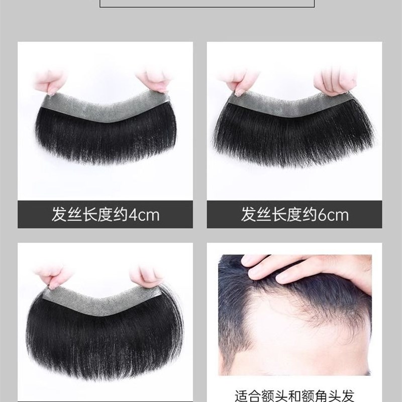 发际线假发贴男士前额自然轻薄补发片隐形无痕真发M型额头刘海片