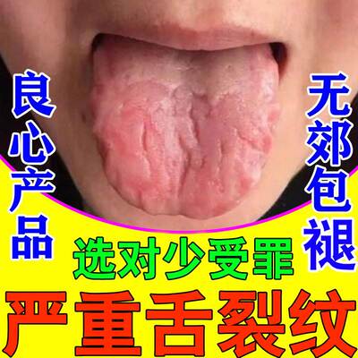 极速地图舌裂纹舌尖发麻舌头肥大齿痕舌神器舌苔发白厚黄起泡刺痛