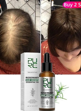 Rosemary Oil Hair Growth Products Ginger Anti Loss Fast