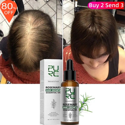 Rosemary Oil Hair Growth Products Ginger Anti Loss Fast