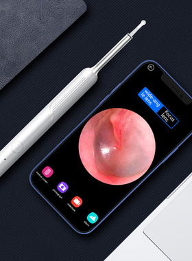 Endoscope High-Definition Visual Ear Scoop Intelligent Wirel