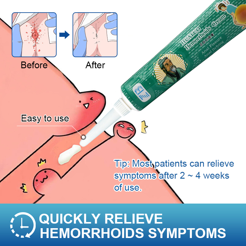 20g Hemorrhoids Ointment For Internal Hemorrhoids Piles Exte
