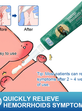20g Hemorrhoids Ointment For Internal Hemorrhoids Piles Exte
