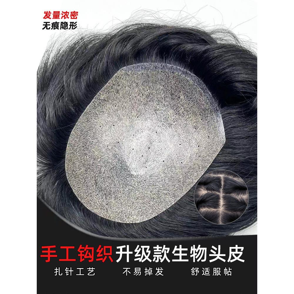 全扎针生物膜假发男士补发块真人发仿真头皮帅气无痕补发头顶遮秃