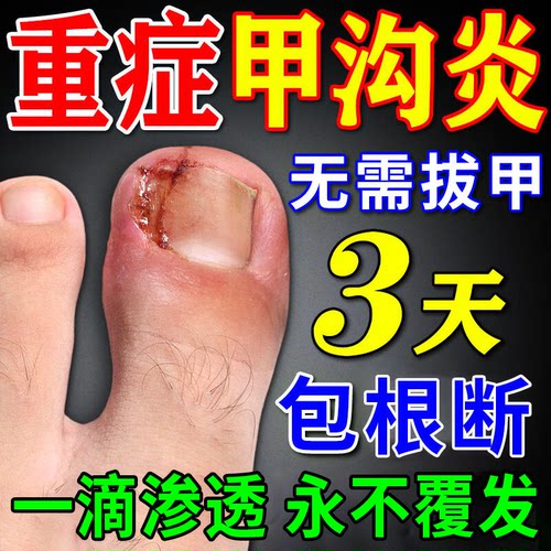 【同仁堂出品】已帮助100W人