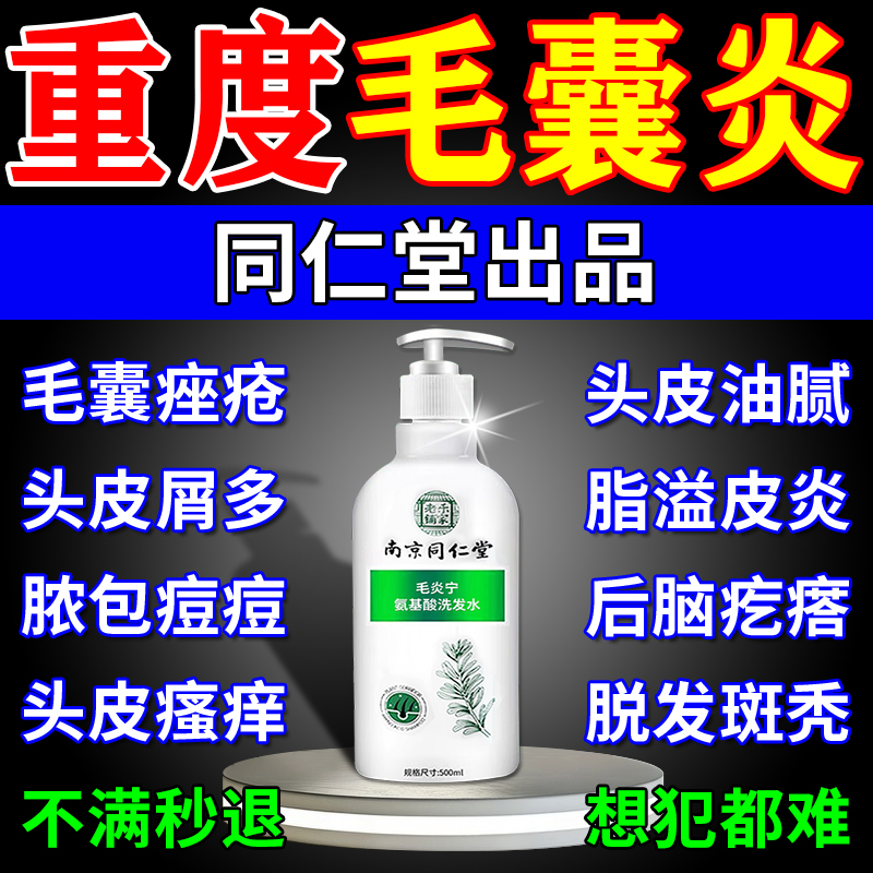 【毛囊炎洗发水】-已治愈30W患者