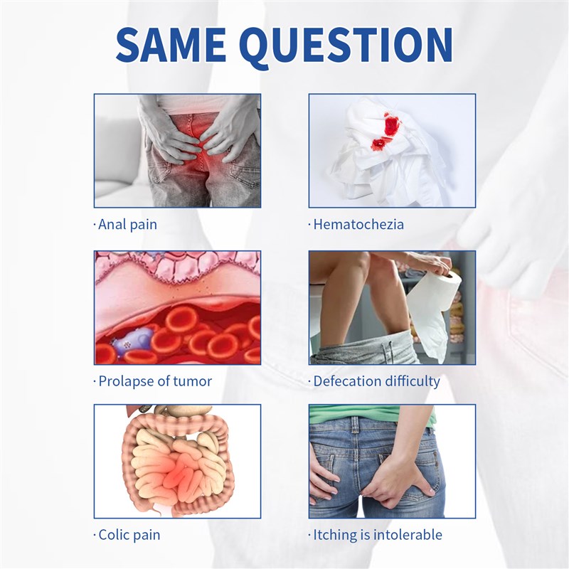 Hemorrhoid Ointment  Effective Treatment Internal  Piles Ext