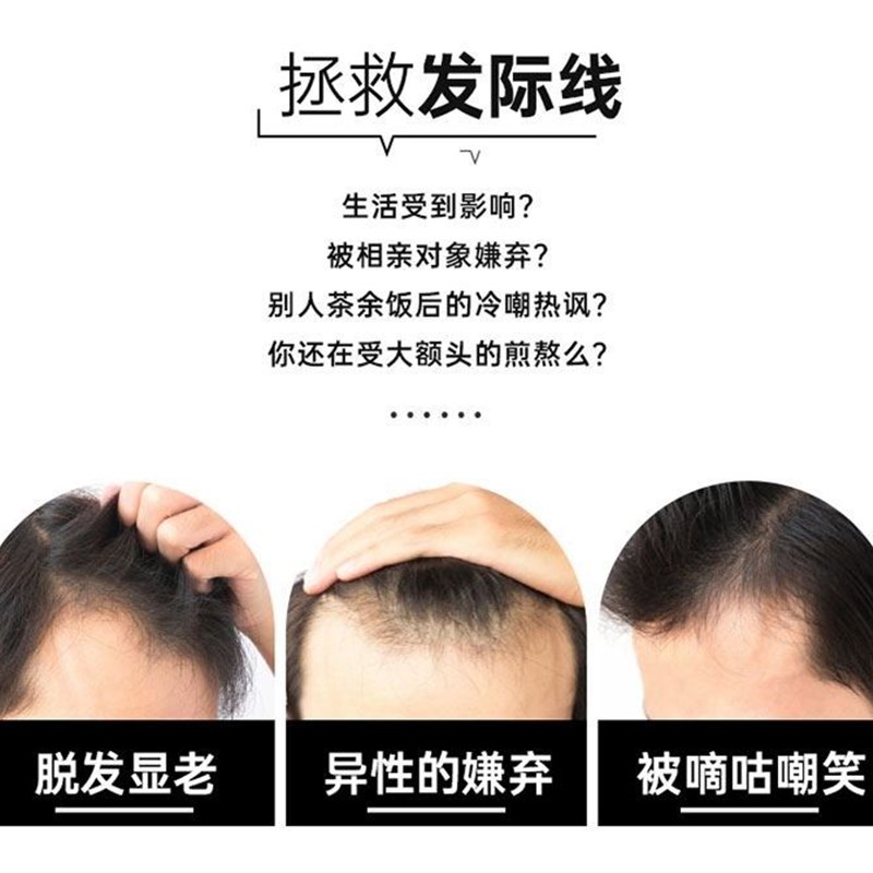 发际线假发贴前额假发发际线贴片男士额头补发片刘海贴无痕假发片