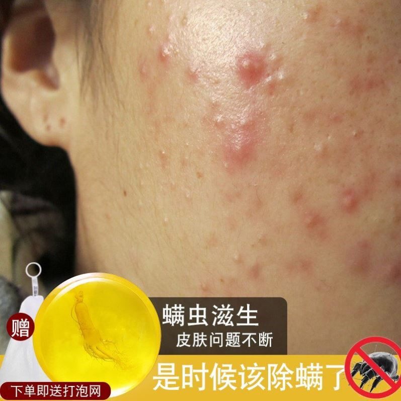 苦参洁面除螨虫香皂洗脸澡去螨专用沐浴全身女男人参祛痘硫磺肥皂