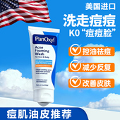 PanOxyl10%过氧化苯甲酰BPO祛痘洗面奶28g控油去痘清洁 临期