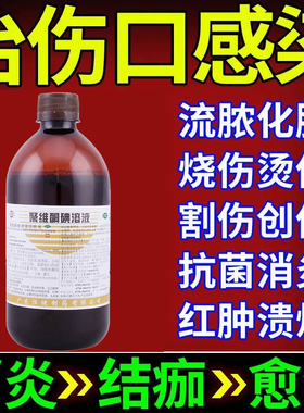 聚维酮碘溶液500ml化脓性皮炎烫伤医用消毒液杀菌皮肤真菌感染LM