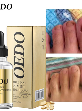 OHealthy Nail Care Fungus Nail Repair Essential Oil Hand and