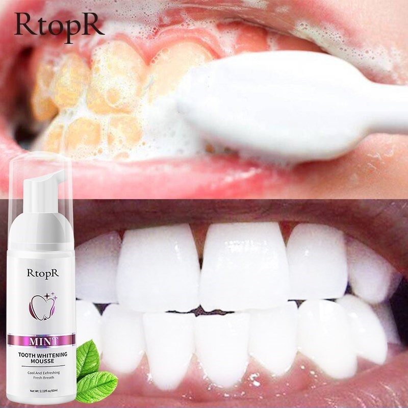 Teeth Cleansing Whitening Mousse Removes Sta Teeth Whitening
