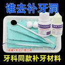 补牙补缝堵牙洞膏材料填充剂儿童补牙齿有洞堵龋蛀牙虫补牙树脂