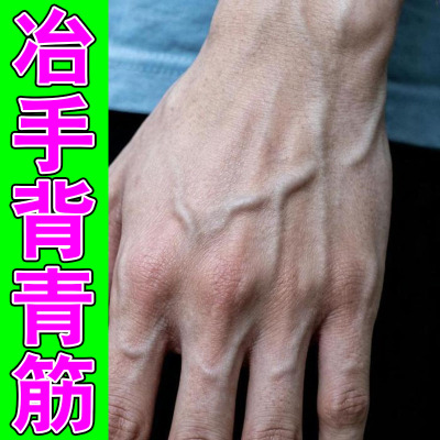 手背筋络鼓出血管显眼手掌青筋扩张凸起手背手腕青筋突出鼓包