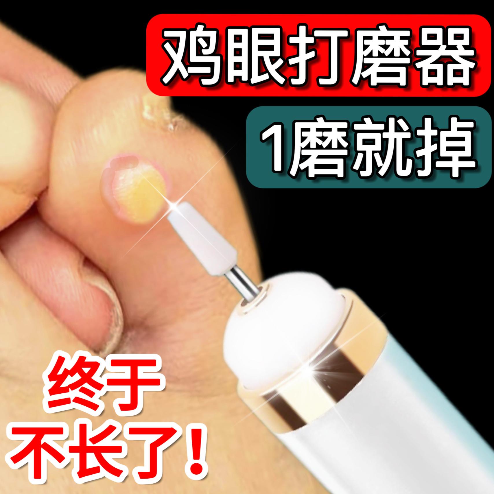 电动鸡眼打磨器刀跖疣修脚刀去老茧修圆头扦脚工具挖鸡眼神扦刀除