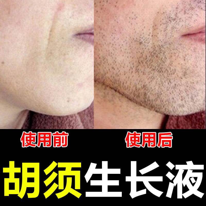 胡须生长液增长液胡子增密长胡子神器眉毛鬓角胸毛增毛膏男浓密.