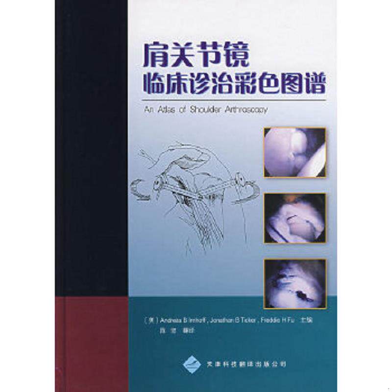 正版速发9787543321182 肩关节镜临床诊治彩色图谱 （美）安缀斯等主编,陈坚译 天津科技翻译出版公司